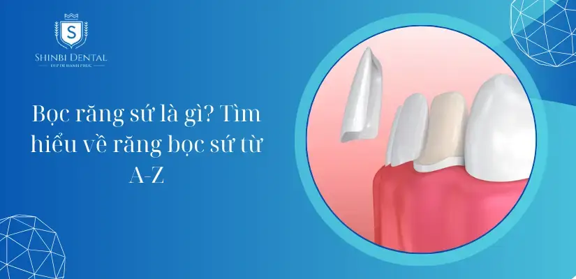 Bọc răng sứ là gì? Các loại, Phương pháp và Quy trình