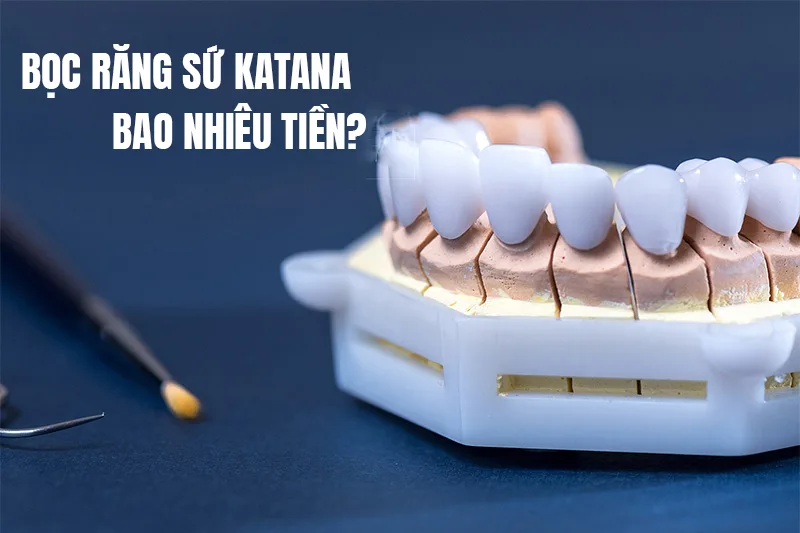 giá bọc răng sứ Katana bao nhiêu tiền giá bọc răng sứ Katana bao nhiêu tiền