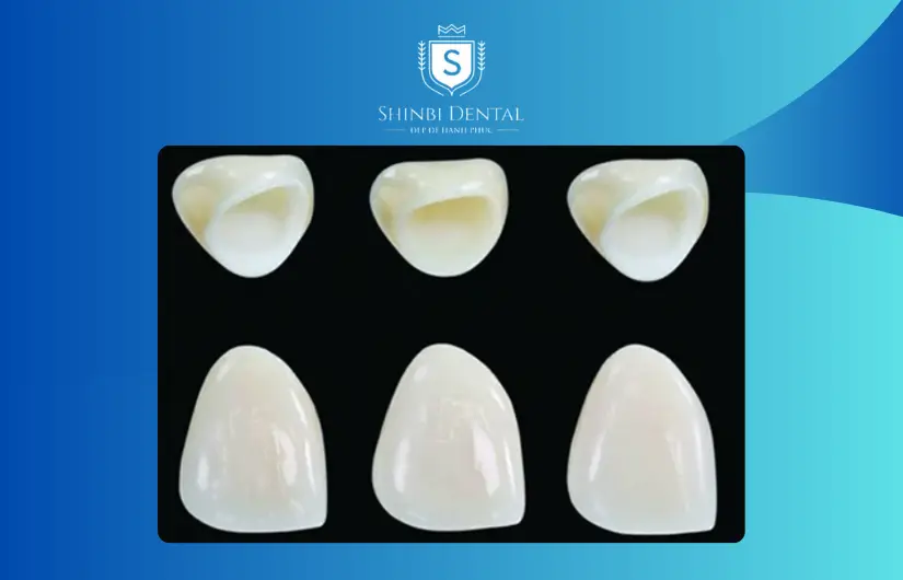 Các loại răng sứ Venus Các loại răng sứ Venus