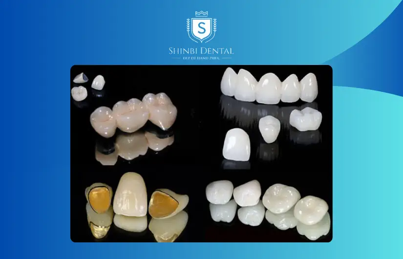 giá làm cầu răng sứ phụ thuộc vào loại răng giá làm cầu răng sứ phụ thuộc vào loại răng
