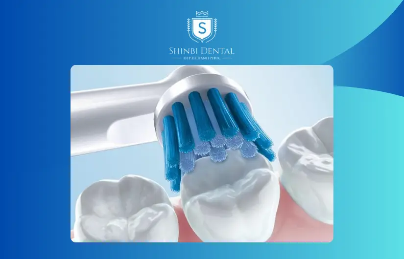 Chăm sóc và vệ sinh răng miệng