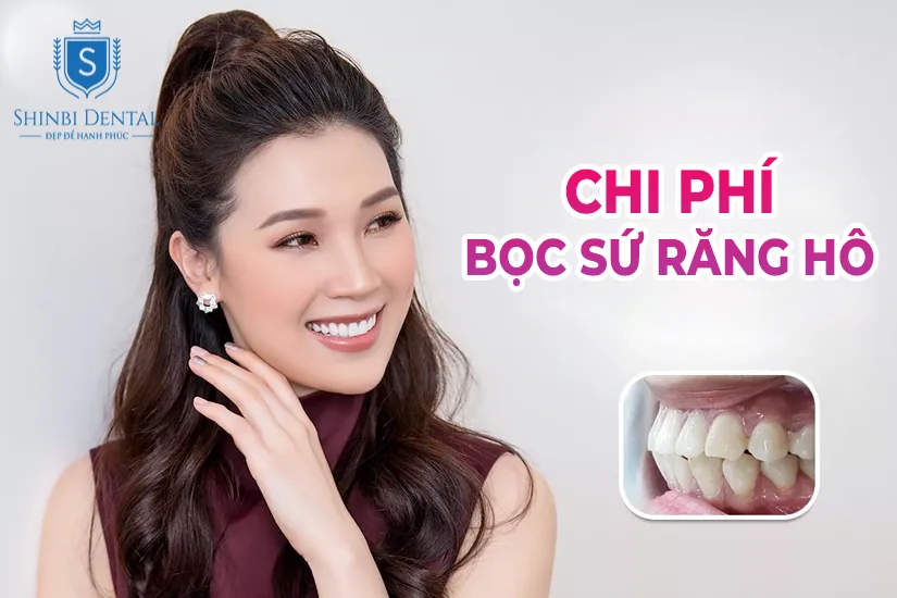 chi phí bọc răng sứ cho răng hô bao nhiêu tiền chi phí bọc răng sứ cho răng hô bao nhiêu tiền