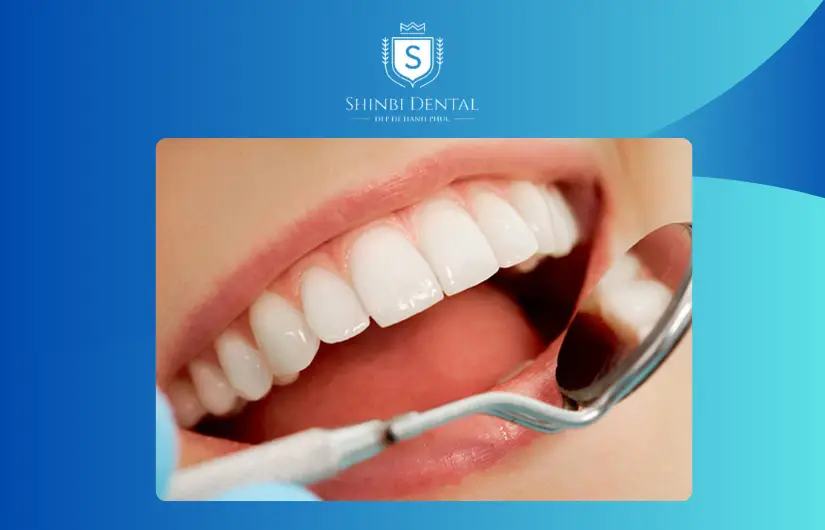 Giá bị ảnh hưởng bởi dịch vụ chăm sóc