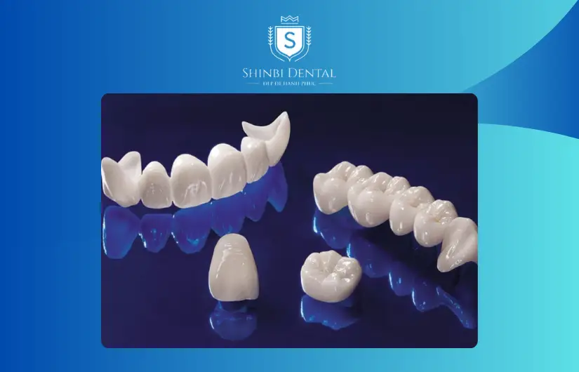Giá bị ảnh hưởng bởi chất liệu răng sứ Giá bị ảnh hưởng bởi chất liệu răng sứ