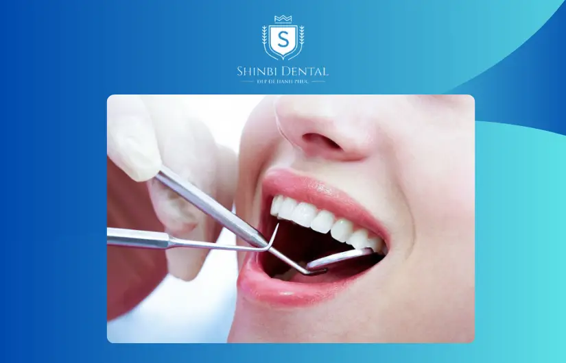 Kiểm tra răng miệng tổng quảt Kiểm tra răng miệng tổng quảt