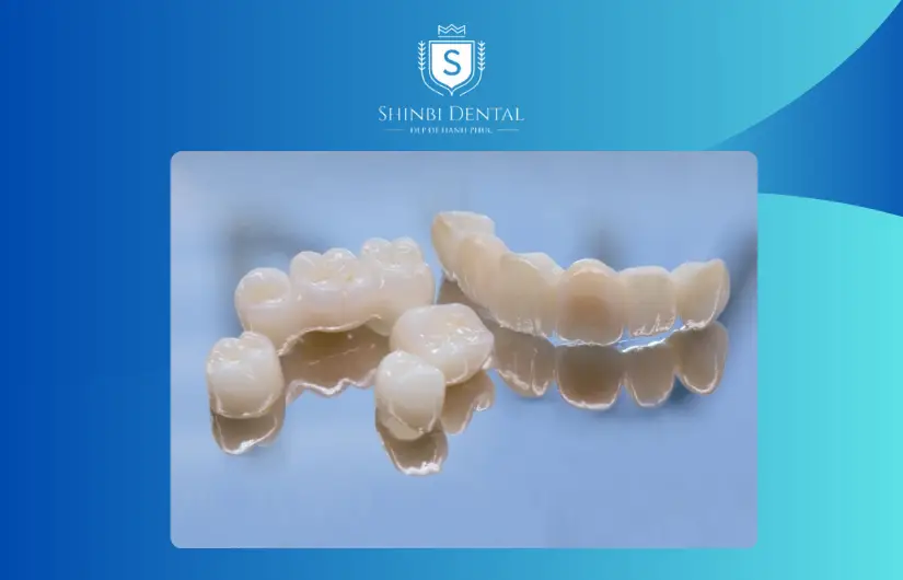 Răng sứ toàn sứ Răng sứ toàn sứ