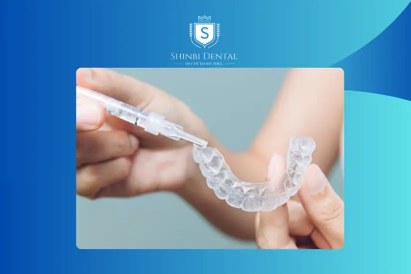 Tẩy trắng tại nhà dưới sự hướng dẫn của nha sĩ