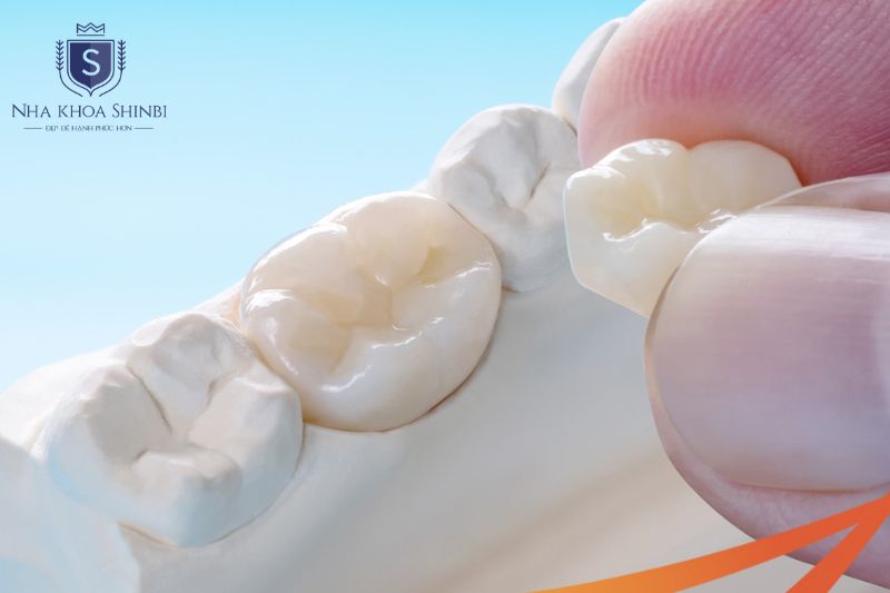 Giai đoạn 2 thanh toán 30 phần trăm còn lại cùng abutment và mão sứ không phát sinh chi phí 