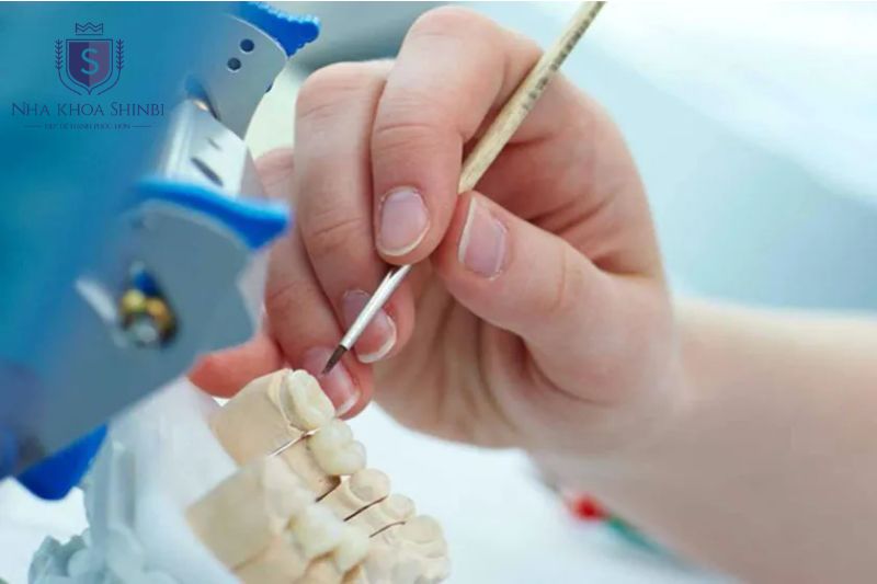 Quy trình cấy implant cần CBCT và thiết bị chuyên dụng để đảm bảo chính xác và an toàn