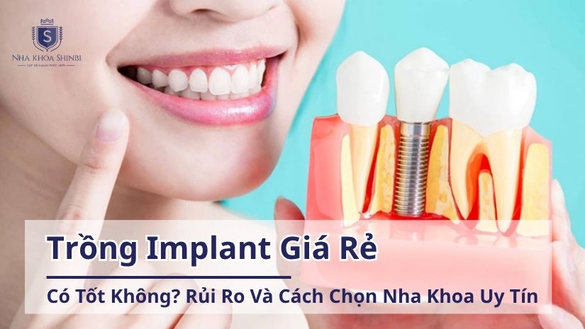 Trồng Implant Giá Rẻ Có Tốt Không? Rủi Ro Thực Sự và Cách Chọn Nha Khoa Uy Tín