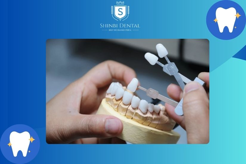 Răng toàn sứ có độ bền cao theo thời gian Răng toàn sứ có độ bền cao theo thời gian