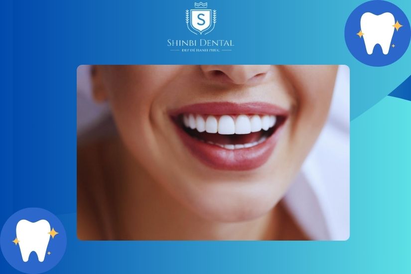 Bọc sứ giúp cải thiện hiệu quả tình trạng răng thưa, khe hở răng quá lớn Bọc sứ giúp cải thiện hiệu quả tình trạng răng thưa, khe hở răng quá lớn