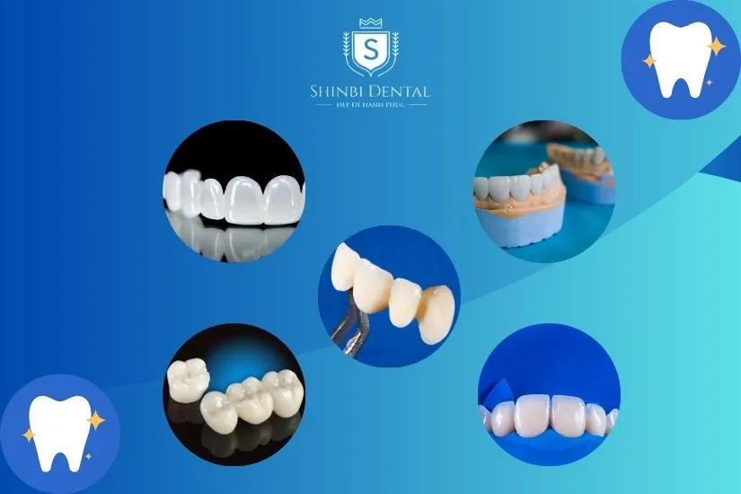 Những lưu ý quan trọng khi bọc răng sứ cho trẻ