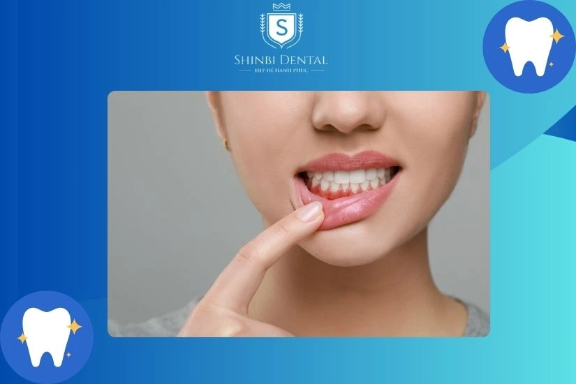 Chăm sóc răng miệng sai cách gây tụt nướu