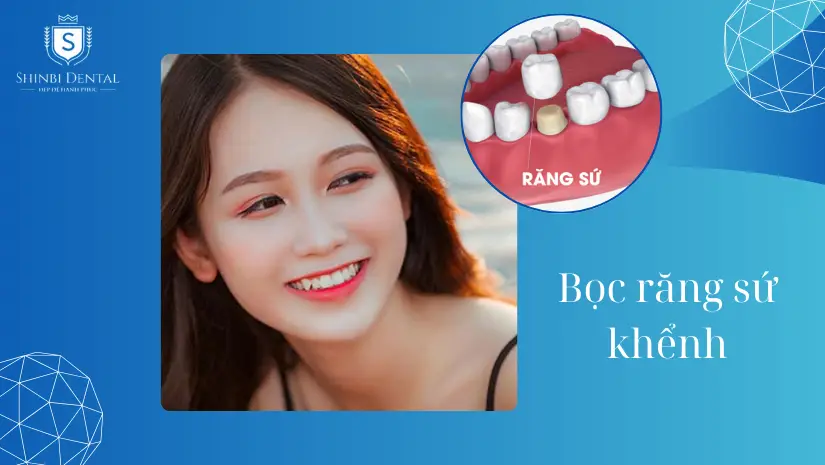 Bọc răng sứ khểnh: Là gì? Nên hay không? Quy trình chuẩn