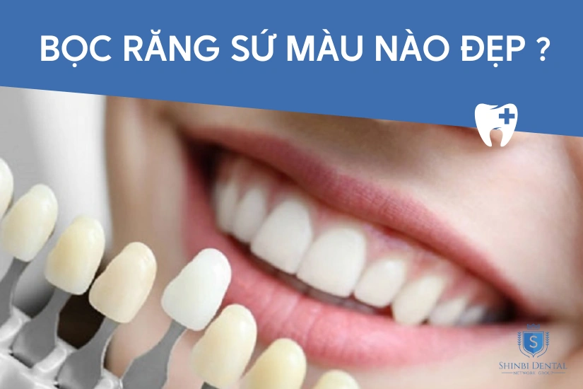 Bọc rắng sứ màu nào đẹp Bọc rắng sứ màu nào đẹp