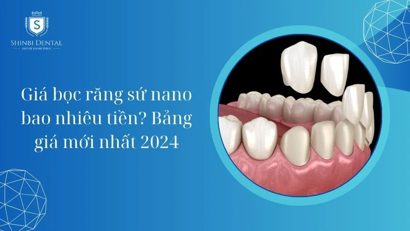 Giá bọc răng sứ Nano bao nhiêu tiền? Bảng giá 2025