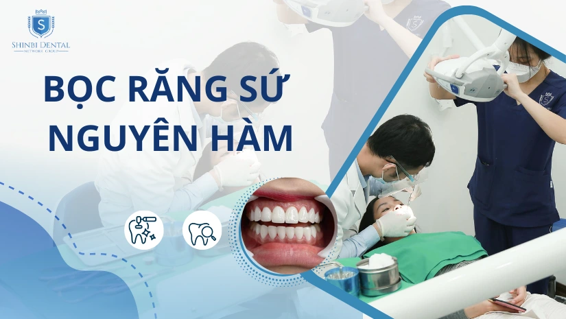 Chi phí bọc răng sứ nguyên hàm bao nhiêu tiền? Bảng giá
