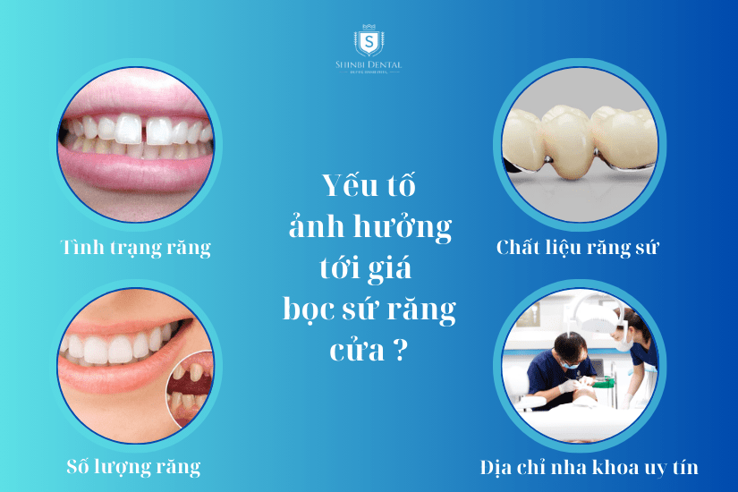 các yếu tố giá bọc răng sứ răng cửa các yếu tố giá bọc răng sứ răng cửa
