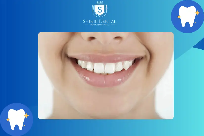 Bọc răng sứ giúp hạn chế được bệnh lý răng miệng