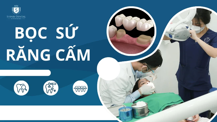 Bọc sứ răng cấm có an toàn không? Giá bao nhiêu?