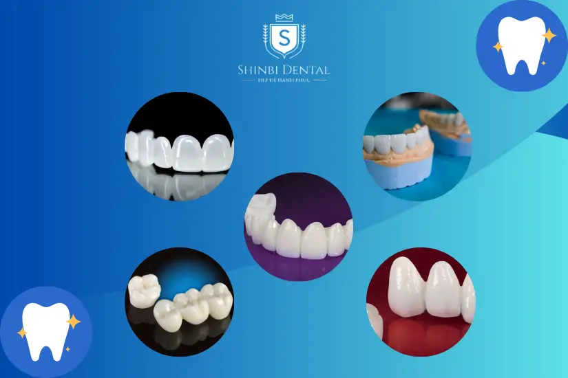 Các loại răng sứ của Shinbi Dental Các loại răng sứ của Shinbi Dental