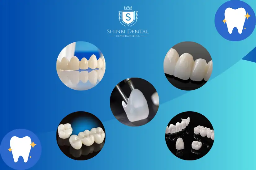 Các loại răng sứ trên thị trường Các loại răng sứ trên thị trường