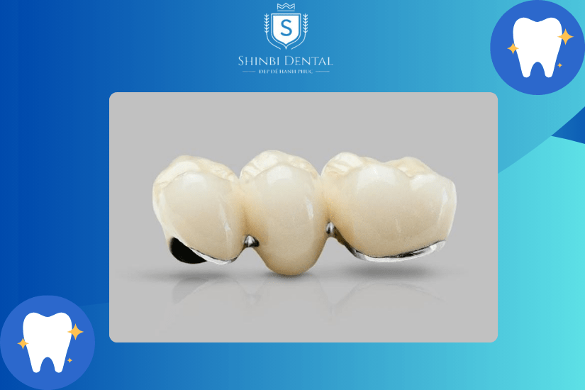Chất liệu răng sứ ảnh hưởng tới giá Chất liệu răng sứ ảnh hưởng tới giá