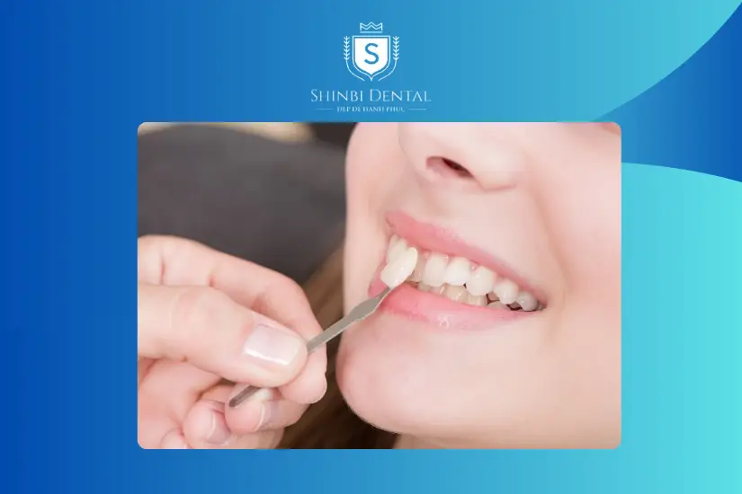 Dán răng sứ không cần mài răng nhiều Dán răng sứ không cần mài răng nhiều