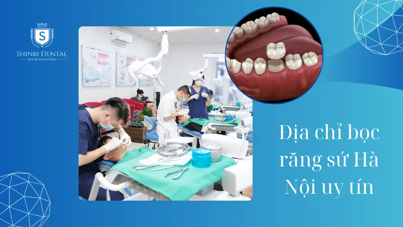 Top 11 địa chỉ làm răng sứ đẹp nhất, tốt nhất tại Hà Nội