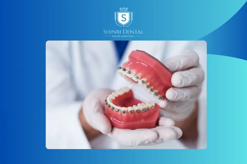 Địa chỉ nha khoa ảnh hưởng tới chi phí niềng răng Địa chỉ nha khoa ảnh hưởng tới chi phí niềng răng
