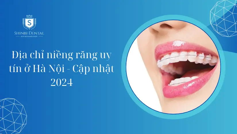 Top 10 địa chỉ niềng răng thẩm mỹ tốt, uy tín ở Hà Nội