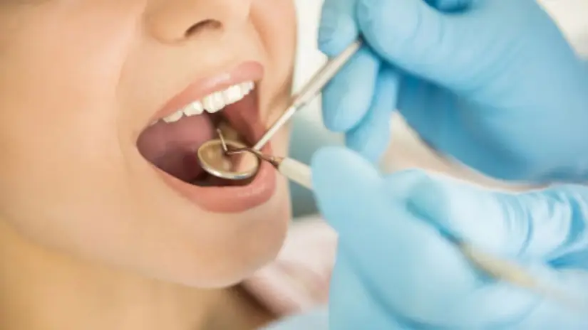 Điều trị duy trì bệnh nha chu Điều trị duy trì bệnh nha chu
