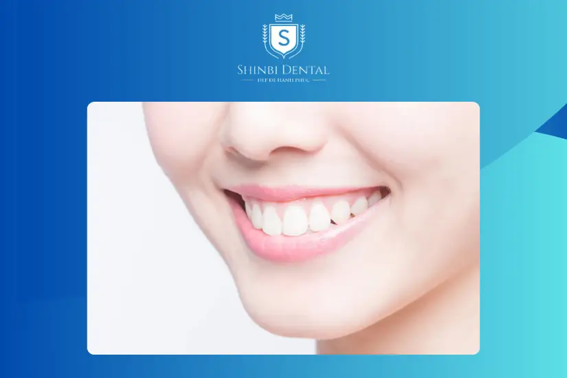 điều kiện tham gia chương trình