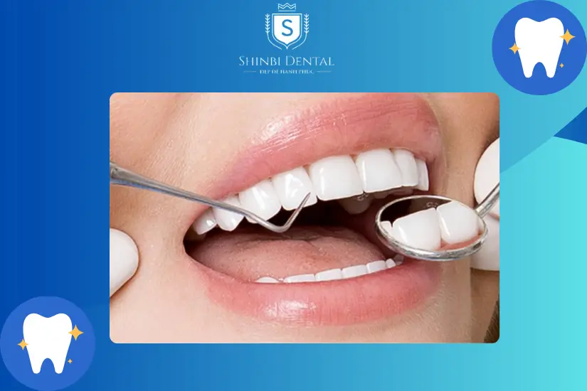Tiến hành gắn răng sứ cố định
