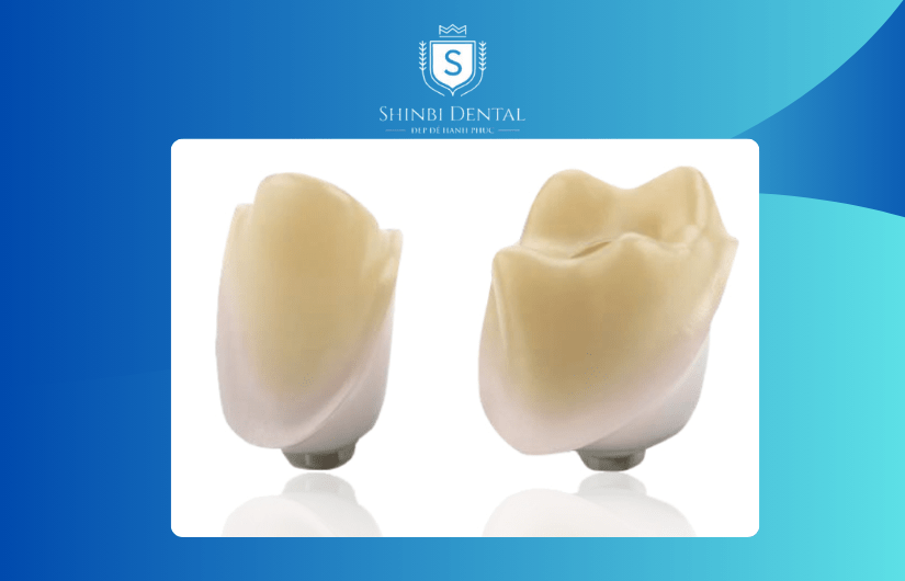 Răng sứ Ceramill được cấu tạo hoàn toàn từ sứ Răng sứ Ceramill được cấu tạo hoàn toàn từ sứ