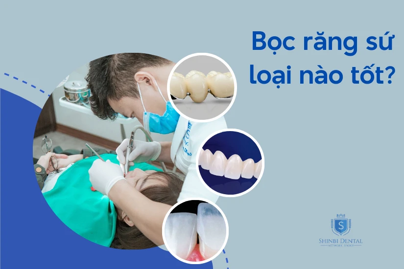 Giải đáp nên bọc răng sứ loại nào tốt? Giải đáp nên bọc răng sứ loại nào tốt?