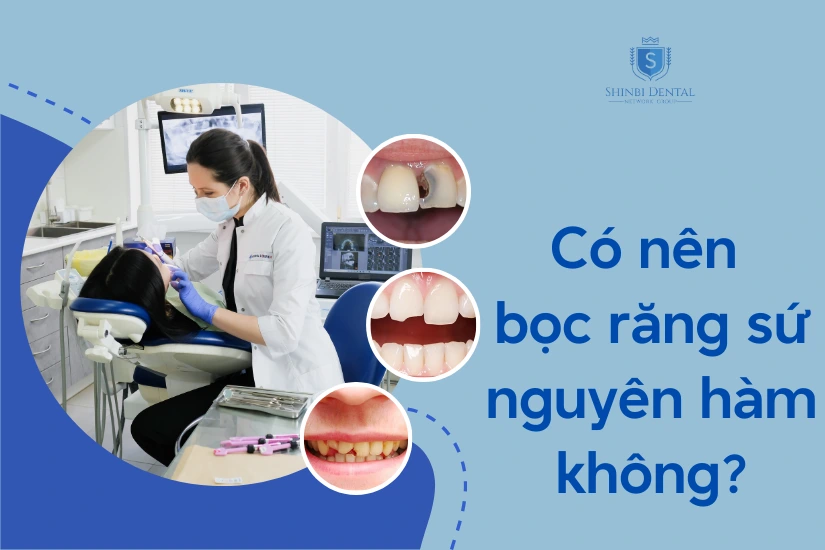 Giải đáp thắc mắc có nên bọc răng sứ nguyên hàm không?