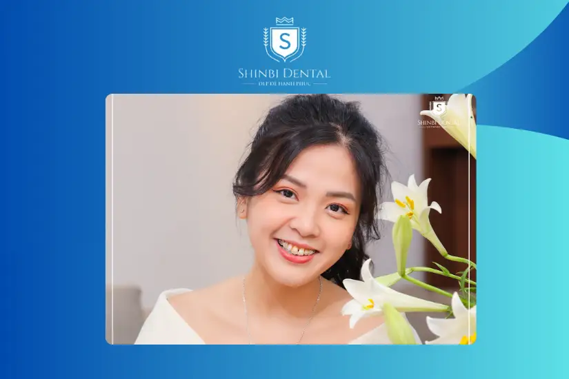 Kết quả niềng răng ở Shinbi Kết quả niềng răng ở Shinbi
