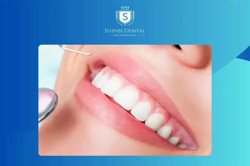 điều kiện đơn giản