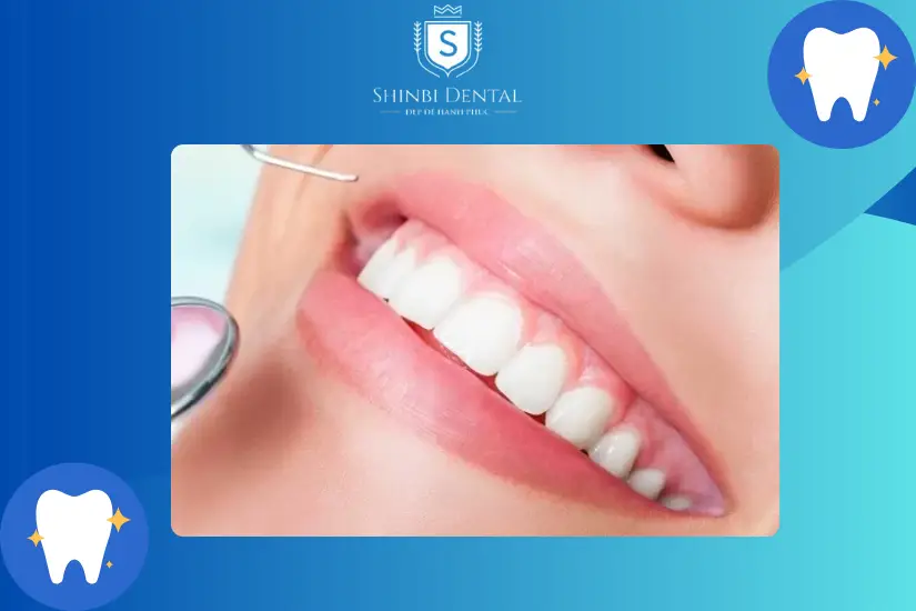 Lưu ý khi bọc răng sứ cho người bị nha chu Lưu ý khi bọc răng sứ cho người bị nha chu