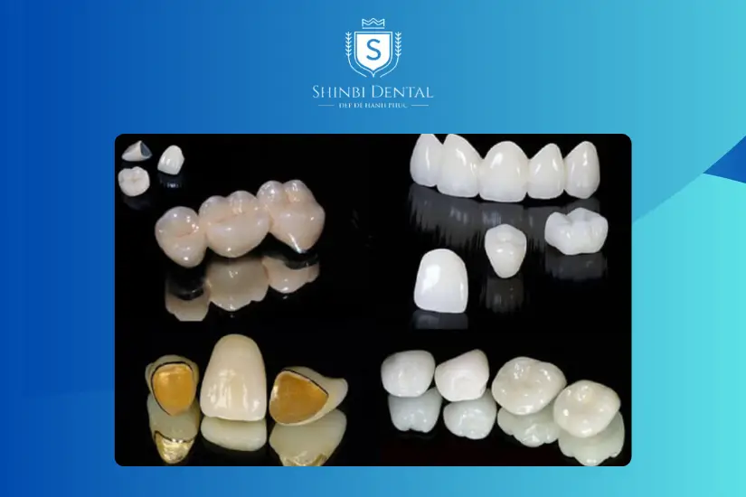 Chọn loại răng sứ để bọc Chọn loại răng sứ để bọc