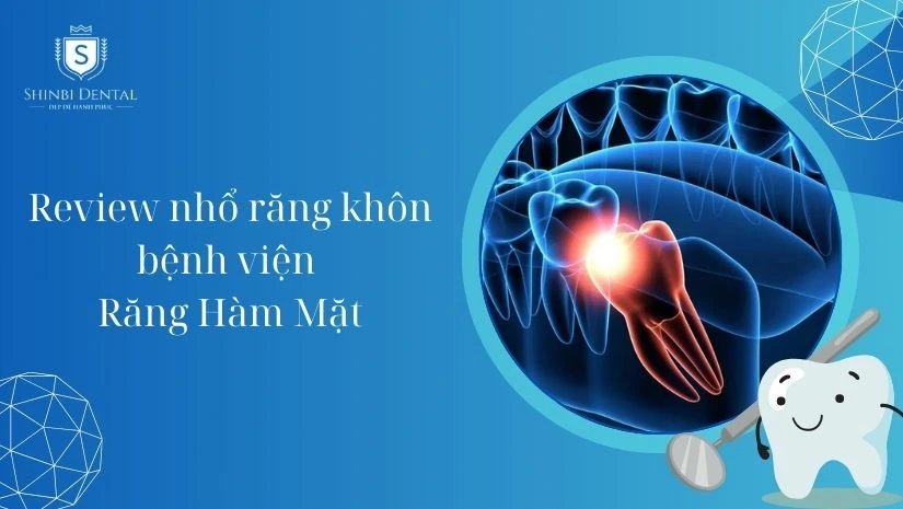 Nhổ răng khôn bệnh viện răng hàm mặt Trung Ương