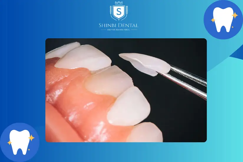 Nhược điểm của bọc răng sứ không mài Nhược điểm của bọc răng sứ không mài