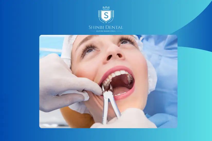 Nhược điểm khi nhổ răng khôn ở nha khoa