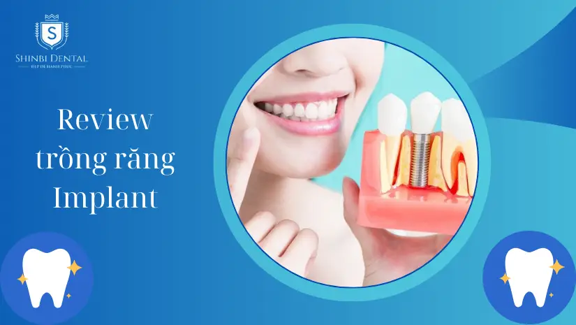 Review trồng răng Implant tại nha khoa Shinbi từ khách hàng
