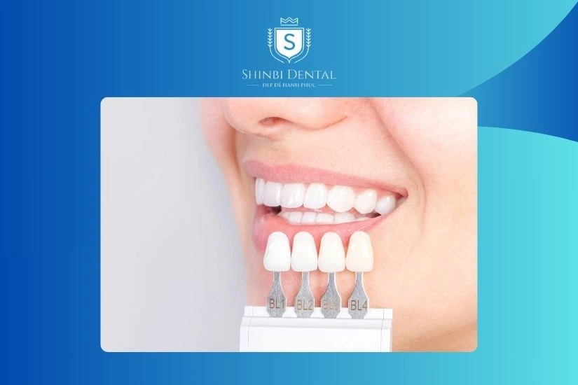 Số lượng răng cần bọc Số lượng răng cần bọc