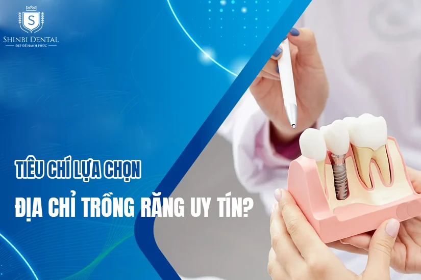 tiêu chí lựa chọn địa chỉ trồng răng uy tín ở Hà Nội