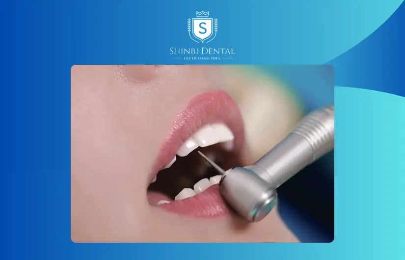 Tình trạng răng ban đầu ảnh hưởng tới giá mài bọc răng sứ Tình trạng răng ban đầu ảnh hưởng tới giá mài bọc răng sứ