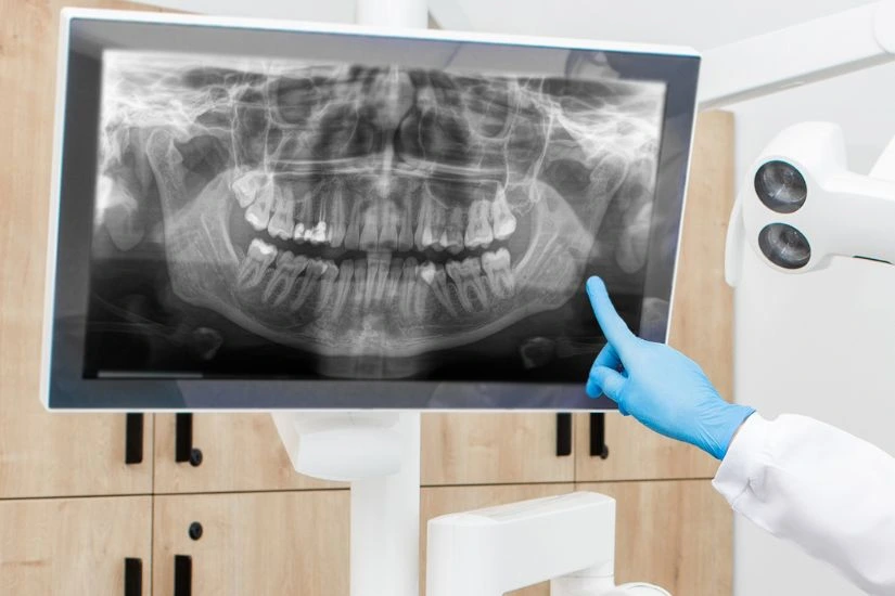 Chọn bác sĩ nhổ răng khôn giỏi cần xem xét nhiều tiêu chí